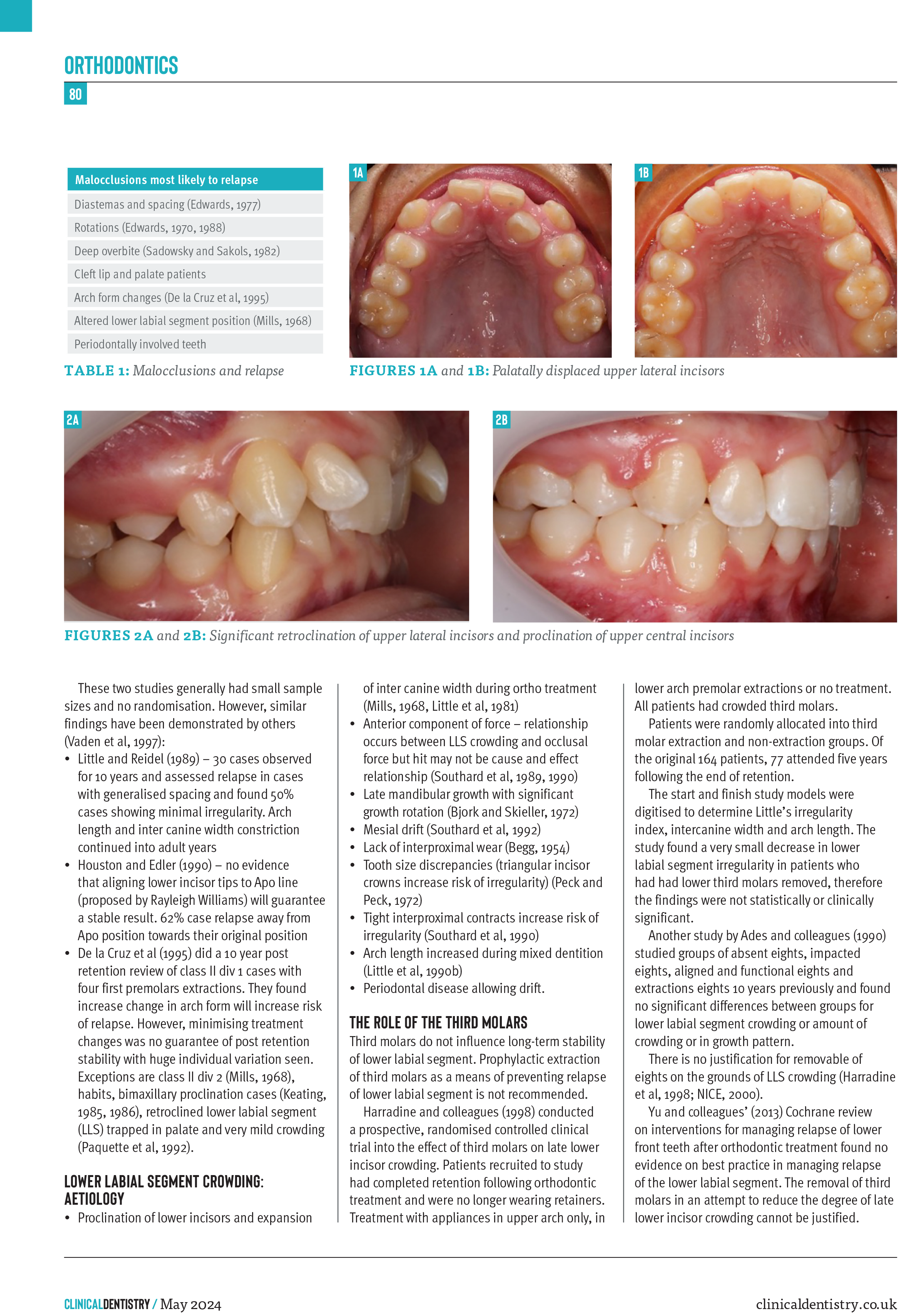 orthodontics-mohammed