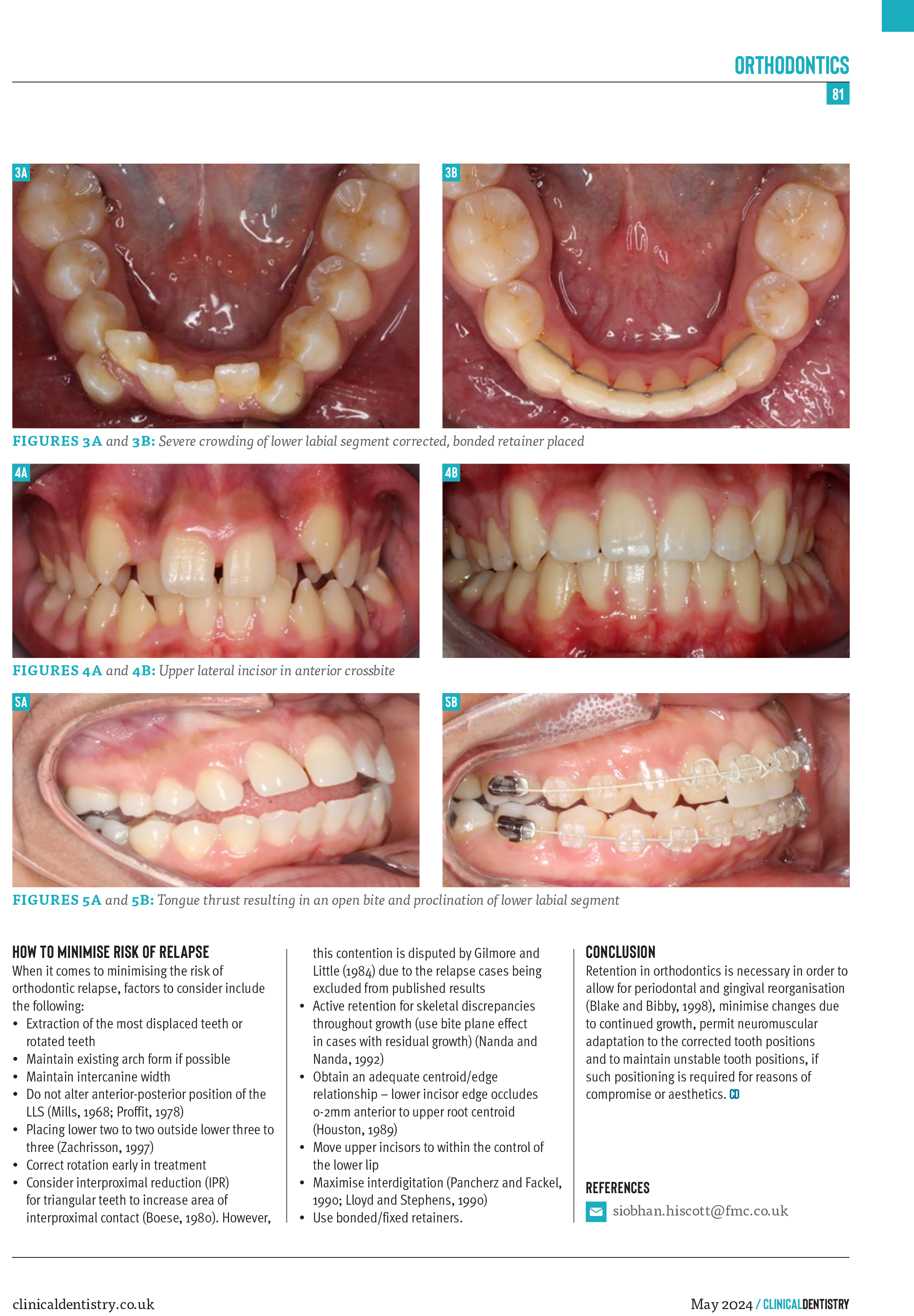 orthodontics-mohammed